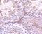 Glucose-6-Phosphate Dehydrogenase antibody, NBP2-66870, Novus Biologicals, Immunohistochemistry paraffin image 