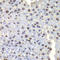 LIM/homeobox protein Lhx4 antibody, A05503, Boster Biological Technology, Immunohistochemistry paraffin image 