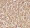 Coenzyme Q10A antibody, FNab01876, FineTest, Immunohistochemistry paraffin image 