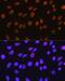 Histone Deacetylase 1 antibody, GTX08970, GeneTex, Immunohistochemistry paraffin image 