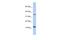 Nucleoredoxin Like 2 antibody, A16303, Boster Biological Technology, Western Blot image 