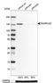 SWI/SNF Related, Matrix Associated, Actin Dependent Regulator Of Chromatin, Subfamily A, Member 5 antibody, NBP1-89692, Novus Biologicals, Western Blot image 