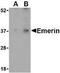 Emerin antibody, NBP1-76757, Novus Biologicals, Western Blot image 