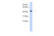 Sphingomyelin Synthase 2 antibody, 26-740, ProSci, Western Blot image 