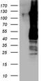 Protein Phosphatase 6 Regulatory Subunit 2 antibody, TA890148S, Origene, Western Blot image 
