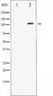 ATPase Na+/K+ Transporting Subunit Alpha 1 antibody, TA325239, Origene, Western Blot image 