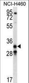 Growth Differentiation Factor 15 antibody, LS-B8774, Lifespan Biosciences, Western Blot image 
