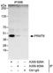 Protein Arginine Methyltransferase 6 antibody, A300-928A, Bethyl Labs, Immunoprecipitation image 