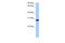 Transcription Elongation Factor A N-Terminal And Central Domain Containing 2 antibody, A14504, Boster Biological Technology, Western Blot image 