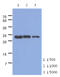 Troponin I1, Slow Skeletal Type antibody, AM50025PU-N, Origene, Western Blot image 