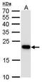 Transgelin antibody, MA5-17288, Invitrogen Antibodies, Western Blot image 