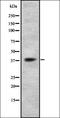 Purinergic Receptor P2Y14 antibody, orb337458, Biorbyt, Western Blot image 