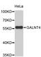Polypeptide N-Acetylgalactosaminyltransferase 4 antibody, STJ26586, St John