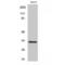 Tumor necrosis factor receptor superfamily member 6B antibody, LS-C383098, Lifespan Biosciences, Western Blot image 