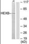 Beta-N-acetylhexosaminidase subunit beta antibody, orb96499, Biorbyt, Western Blot image 