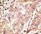 Teratocarcinoma-Derived Growth Factor 1 antibody, PA5-11911, Invitrogen Antibodies, Immunohistochemistry frozen image 
