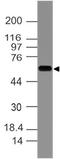 Keratin 77 antibody, M14209, Boster Biological Technology, Western Blot image 