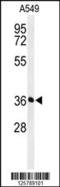 Proteasomal ATPase Associated Factor 1 antibody, 61-776, ProSci, Western Blot image 