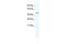 DEAD-Box Helicase 49 antibody, GTX47505, GeneTex, Western Blot image 