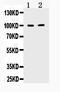 Transforming Acidic Coiled-Coil Containing Protein 1 antibody, A04196, Boster Biological Technology, Western Blot image 