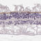 Membrane Palmitoylated Protein 5 antibody, HPA063890, Atlas Antibodies, Immunohistochemistry paraffin image 