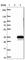 Uroporphyrinogen III Synthase antibody, HPA044038, Atlas Antibodies, Western Blot image 