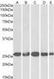 G Protein Nucleolar 3 antibody, 43-686, ProSci, Enzyme Linked Immunosorbent Assay image 