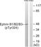 EPH Receptor B1 antibody, PA5-37810, Invitrogen Antibodies, Western Blot image 