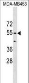 Coronin 1B antibody, LS-C159395, Lifespan Biosciences, Western Blot image 