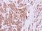 OCRL Inositol Polyphosphate-5-Phosphatase antibody, GTX103107, GeneTex, Immunohistochemistry paraffin image 