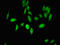Ubiquitin Protein Ligase E3A antibody, LS-C674970, Lifespan Biosciences, Immunofluorescence image 