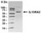 Interleukin 13 Receptor Subunit Alpha 2 antibody, XW-8076, ProSci, Western Blot image 