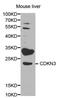 Cyclin Dependent Kinase Inhibitor 3 antibody, MBS126982, MyBioSource, Western Blot image 