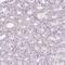 Zinc Finger Protein 688 antibody, NBP2-30749, Novus Biologicals, Immunohistochemistry paraffin image 