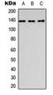 Collagen Type I Alpha 1 Chain antibody, LS-C354330, Lifespan Biosciences, Western Blot image 