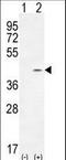 hA6RP antibody, LS-C162287, Lifespan Biosciences, Western Blot image 