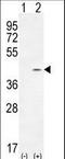 Twinfilin Actin Binding Protein 2 antibody, LS-C162287, Lifespan Biosciences, Western Blot image 