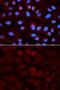 Aldehyde Dehydrogenase 3 Family Member A1 antibody, GTX30042, GeneTex, Immunocytochemistry image 