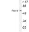 Paired Box 8 antibody, LS-C177524, Lifespan Biosciences, Western Blot image 