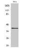 Pyrimidinergic Receptor P2Y4 antibody, STJ94871, St John