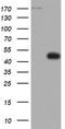 DNA Topoisomerase II Alpha antibody, LS-C336543, Lifespan Biosciences, Western Blot image 