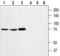 Solute Carrier Family 18 Member A3 antibody, A04891-1, Boster Biological Technology, Western Blot image 