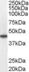 Medium-chain specific acyl-CoA dehydrogenase, mitochondrial antibody, EB05674, Everest Biotech, Western Blot image 