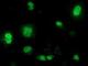 Beta-Transducin Repeat Containing E3 Ubiquitin Protein Ligase antibody, NBP2-03654, Novus Biologicals, Immunofluorescence image 