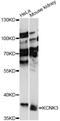 Potassium Two Pore Domain Channel Subfamily K Member 3 antibody, LS-C749726, Lifespan Biosciences, Western Blot image 