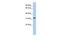 Cilia And Flagella Associated Protein 161 antibody, GTX45572, GeneTex, Western Blot image 