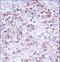 AP2 Associated Kinase 1 antibody, LS-C164282, Lifespan Biosciences, Immunohistochemistry paraffin image 