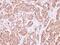 Actin Like 8 antibody, NBP1-33497, Novus Biologicals, Immunohistochemistry paraffin image 