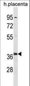 Proteasome 26S Subunit, Non-ATPase 6 antibody, LS-C155873, Lifespan Biosciences, Western Blot image 