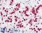 Apoptotic Chromatin Condensation Inducer 1 antibody, LS-B3190, Lifespan Biosciences, Immunohistochemistry paraffin image 